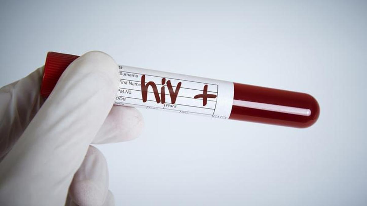 Fiji'de HIV alarmı: Her 60 yetişkinden biri pozitif çıktı! Olağanüstü hal ilan edildi...