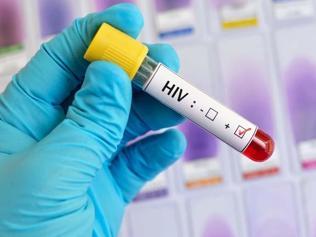 Fiji'de HIV alarmı: Her 60 yetişkinden biri pozitif çıktı! Olağanüstü hal ilan edildi...