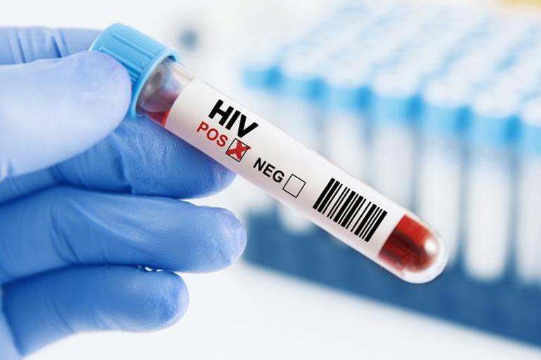 Fiji'de HIV alarmı: Her 60 yetişkinden biri pozitif çıktı! Olağanüstü hal ilan edildi...